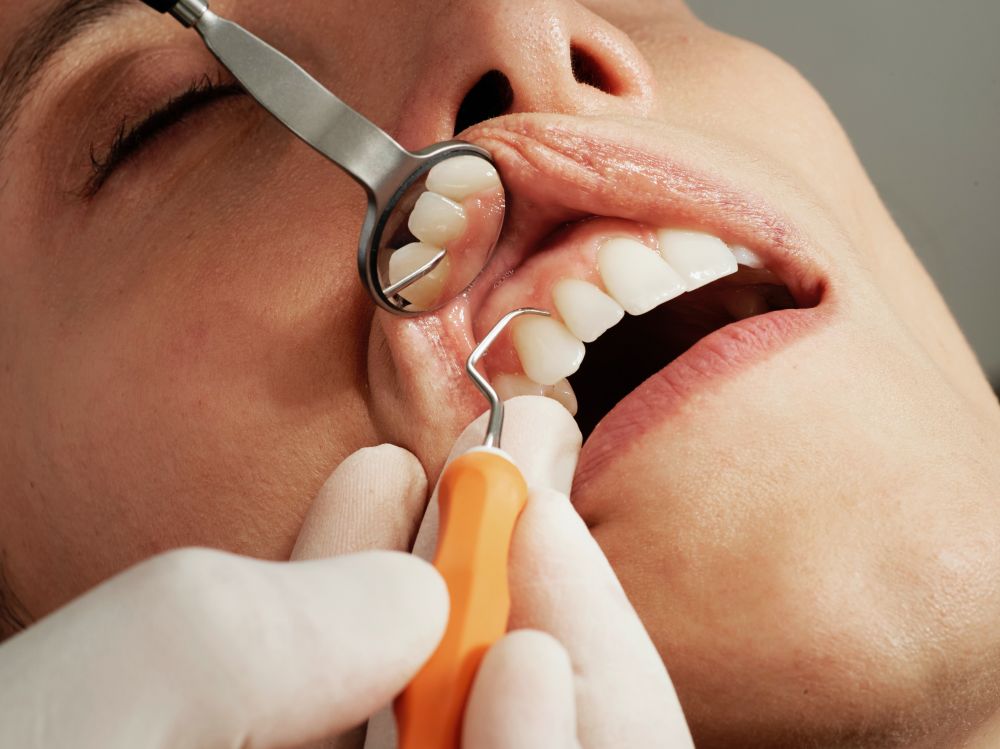 Besøg din tandlæge i Charlottenlund
